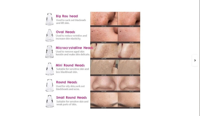 Blackhead Remover 6 in 1 Machine