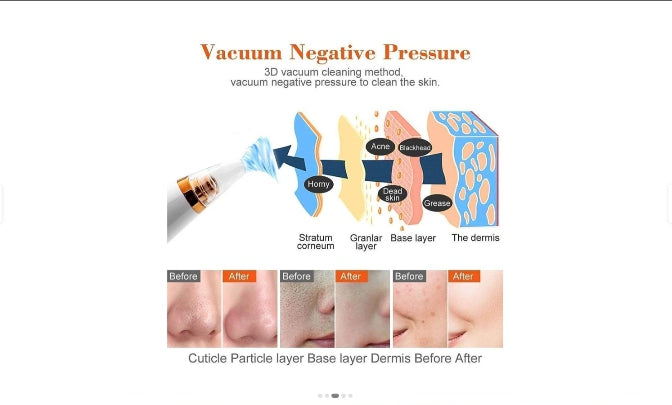Blackhead Remover 6 in 1 Machine